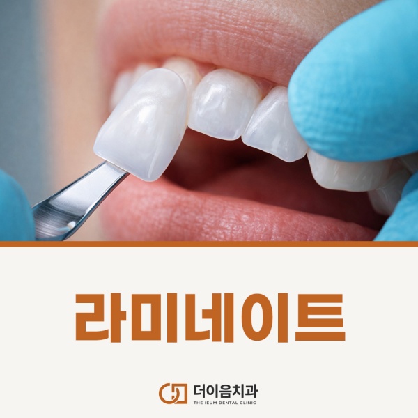 라미네이트로 환한미소